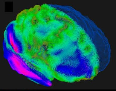 Illustration for article titled This Is What Game Consoles Really Do To Your Brain